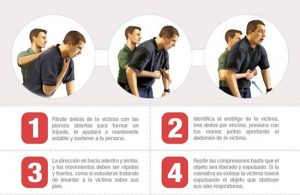 Maniobra de Heimlich